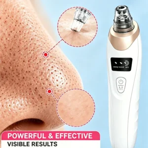 Professional Blackhead Vacuum - Rechargeable Pore Extractor for Blackheads, Oily Skin & Facial Cleansing